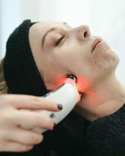 Laserbehandlung Laserbehandlung